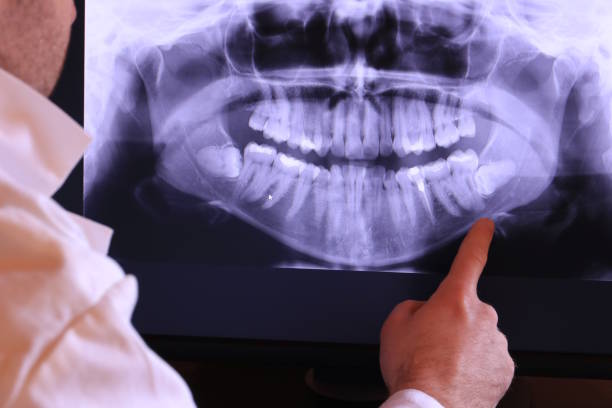 Best Emergency Tooth Extraction in Metter, GA