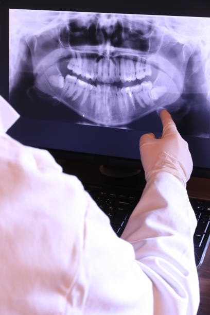 Best Emergency Wisdom Teeth Removal in Metter, GA