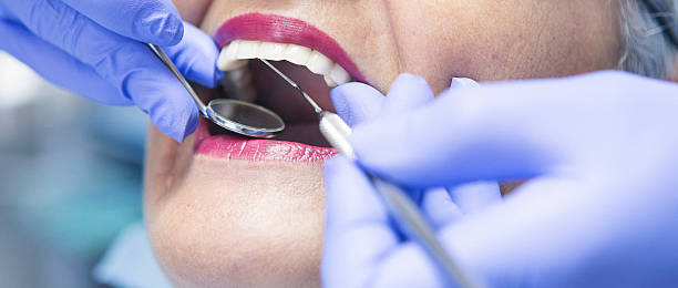 Best Emergency Dental Care for Broken or Chipped Teeth in Metter, GA