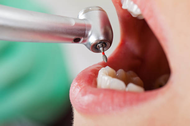 Best Pediatric Emergency Dentist in Metter, GA